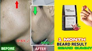 man matters beard gummies review | Man matters beard gummies result | man matters beard gummy |